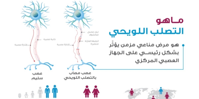 صورة معلومات عن مرض التصلب اللويحي وهذه أبرز أعراضه