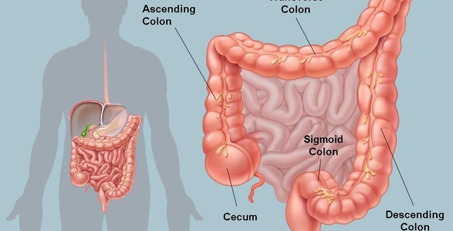 صورة ما هو علاج القولون وأعراضه الأكثر شيوعًا؟  