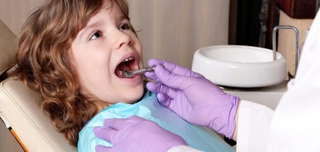 صورة المشروبات السكرية أهم مسببات تسوس الأسنان عند الأطفال